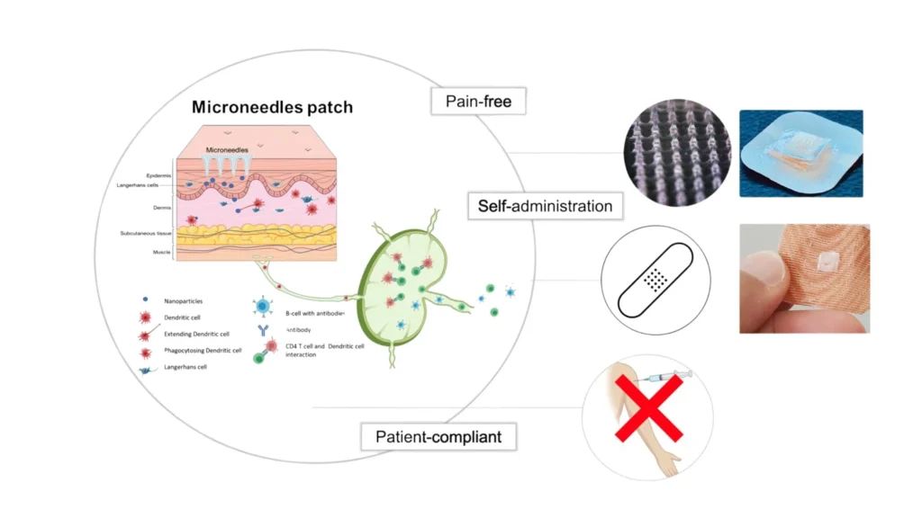 Microneedle Patches