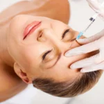 How Botox Injections Can Alleviate Chronic Migraines?
