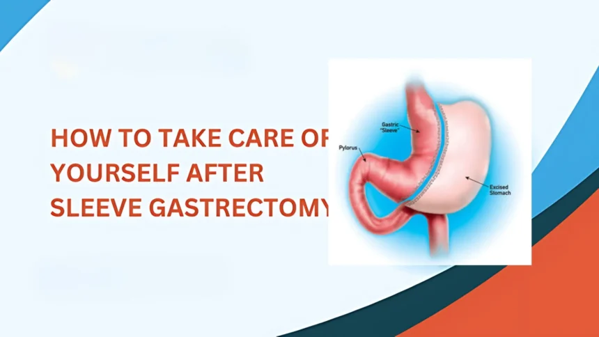 Sleeve Gastrectomy