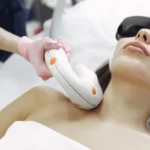 Laser Genesis for Your Skin